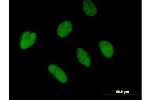 Immunofluorescence of purified MaxPab antibody to BTBD4 on HeLa cell.