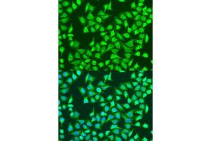 Immunofluorescence analysis of U2OS cells using SIRT4 antibody (ABIN7270326) at dilution of 1:100. (SIRT4 Antikörper  (AA 1-200))