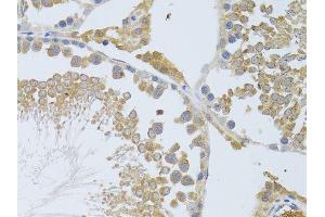 Immunohistochemistry (Paraffin-embedded Sections) (IHC (p)) image for anti-Autophagy Related 13 (ATG13) (AA 281-480) antibody (ABIN3021088)