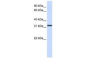 NANOS1 antibody used at 1 ug/ml to detect target protein. (Nanos Homolog 1 Antikörper)