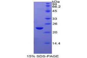 SDS-PAGE (SDS) image for Glucosidase, Alpha, Acid (GAA) (AA 782-953) protein (His tag) (ABIN1879440) (GAA Protein (AA 782-953) (His tag))