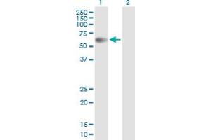 Western Blot analysis of PPM1B expression in transfected 293T cell line by PPM1B MaxPab polyclonal antibody. (PPM1B Antikörper  (AA 1-479))