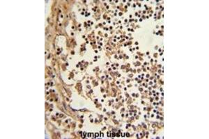 Immunohistochemistry (IHC) image for anti-Eukaryotic Translation Elongation Factor 1 delta (Guanine Nucleotide Exchange Protein) (EEF1D) antibody (ABIN3002663) (EEF1D Antikörper)