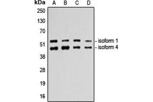 Western blot analysis of p53 expression in A549 (A), HeLa (B), MDAMB231 (C), HepG2 (D) whole cell lysates. (p53 Antikörper  (C-Term))