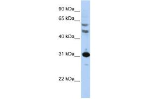 WB Suggested Anti-HOXB5 Antibody Titration: 0. (HOXB5 Antikörper  (N-Term))