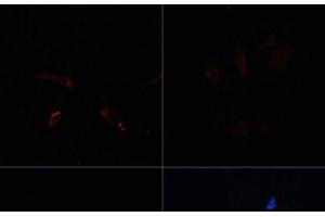 Immunofluorescence (IF) image for anti-Acetyl-CoA Carboxylase alpha (ACACA) antibody (ABIN7258506)