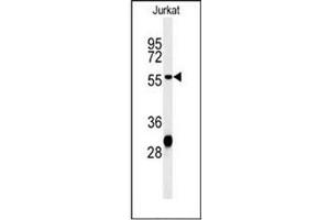 Western blot analysis of HADHB Antibody (C-term) in Jurkat cell line lysates (35ug/lane). (HADHB Antikörper  (C-Term))