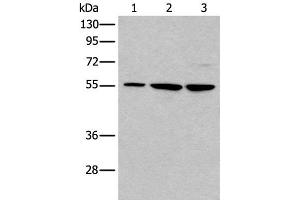 Western blot analysis of 293T and A172 cell lysates using TRIM27 Polyclonal Antibody at dilution of 1:600 (TRIM27 Antikörper)