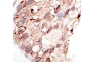 Immunohistochemistry (IHC) image for anti-Suppressor of Variegation 3-9 Homolog 2 (Drosophila) (SUV39H2) (AA 360-390) antibody (ABIN3029054)