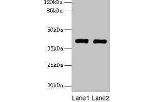 Western blot All lanes: MAB21L1 antibody at 6 μg/mL Lane 1: A375 whole cell lysate Lane 2: CEM whole cell lysate Secondary Goat polyclonal to rabbit IgG at 1/10000 dilution Predicted band size: 41 kDa Observed band size: 41 kDa