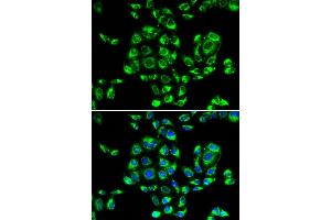 Immunofluorescence analysis of U2OS cells using RPS16 antibody. (RPS16 Antikörper)