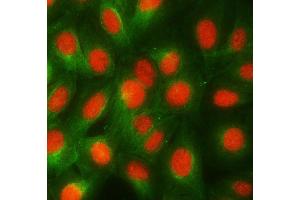 anti-RNA Binding Motif Protein, Y-Linked Family 1 Member A1 (RBMY1A1) (AA 188-496) antibody