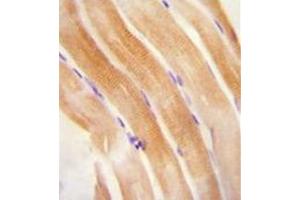 Immunohistochemistry analysis in formalin fixed and paraffin embedded human skeletal muscle reacted with FNIP2 Antibody (C-term) followed by peroxidase conjugation of the secondary antibody and DAB staining.