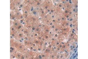 Used in DAB staining on fromalin fixed paraffin- embedded liver tissue (OS9 Antikörper  (AA 466-667))