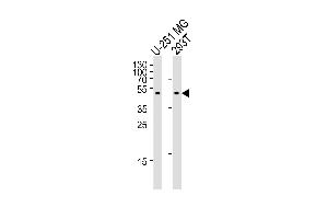 Western blot analysis of lysates from U-251 MG, 293T cell line (from left to right), using C Antibody (Center) (ABIN655405 and ABIN2844951). (CPM Antikörper  (AA 212-241))