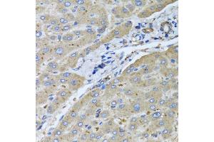 Immunohistochemistry of paraffin-embedded human liver injury using μgT2B10 antibody (ABIN5975607) at dilution of 1/100 (40x lens). (UGT2B10 Antikörper)