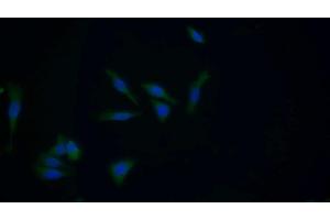 Detection of GSTM1 in Human HepG2 cell using Polyclonal Antibody to Glutathione S Transferase Mu 1 (GSTM1) (GSTM1 Antikörper  (AA 1-220))