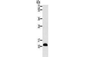 Western Blotting (WB) image for anti-Microseminoprotein, beta (MSMB) antibody (ABIN2423965)