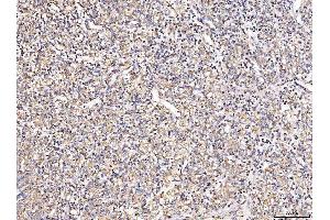 IHC analysis of MT-CO2 using anti-MT-CO2 antibody (ABIN7599081). (COX2 Antikörper  (AA 1-205))