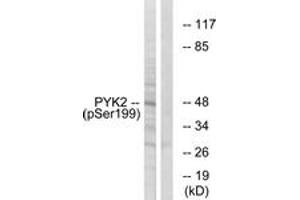 Western Blotting (WB) image for anti-PTK2B Protein tyrosine Kinase 2 beta (PTK2B) (AA 369-418), (pTyr402) antibody (ABIN1531957)