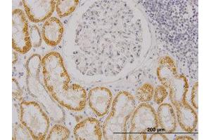 Image no. 2 for anti-RAS Guanyl Releasing Protein 4 (RASGRP4) (AA 574-674) antibody (ABIN599322) (RASGRP4 Antikörper  (AA 574-674))