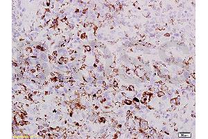 Formalin-fixed and paraffin embedded mouse lung labeled with Rabbit Anti PRAME Polyclonal Antibody, Unconjugated (ABIN721555) at 1:200 followed by conjugation to the secondary antibody and DAB staining (PRAME Antikörper  (AA 151-250))