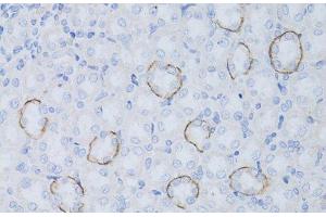 Immunohistochemistry of paraffin-embedded Rat kidney using Aquaporin 4 Polyclonal Antibody at dilution of 1:50 (40x lens). (Aquaporin 4 Antikörper)