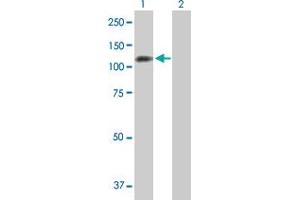 Western Blot analysis of PPP1R13L expression in transfected 293T cell line by PPP1R13L MaxPab polyclonal antibody. (PPP1R13L Antikörper  (AA 1-828))