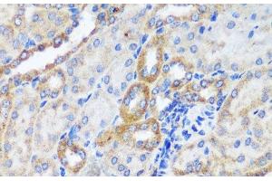 Immunohistochemistry of paraffin-embedded Mouse kidney using ERK1 / ERK2 Polyclonal Antibody at dilution of 1:200 (40x lens). (ERK1/2 Antikörper)