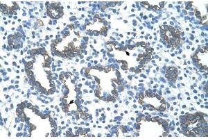 Immunohistochemistry (IHC) image for anti-GNAS Complex Locus (GNAS) (N-Term) antibody (ABIN2775543)