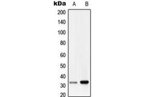 Western blot analysis of RRAD expression in HepG2 (A), human lung (B) whole cell lysates. (RRAD Antikörper  (Center))