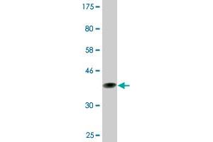 Western Blot detection against Immunogen (37. (CENPJ Antikörper  (AA 979-1088))