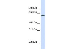 WB Suggested Anti-CAT Antibody Titration: 0. (Catalase Antikörper  (Middle Region))