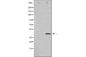 Western blot analysis of extracts of SW620 , using HOXA9 antibody. (HOXA9 Antikörper  (Internal Region))