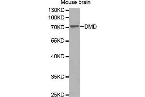 Western Blotting (WB) image for anti-Dystrophin (DMD) (AA 346-635) antibody (ABIN1679546) (Dystrophin Antikörper  (AA 346-635))