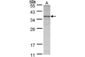 WB Image Sample (30 ug of whole cell lysate) A: A431 , 12% SDS PAGE antibody diluted at 1:500