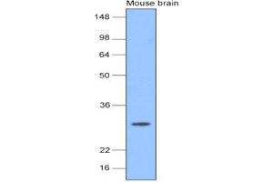 Western Blotting (WB) image for anti-Ubiquitin Carboxyl-terminal Esterase L1 (Ubiquitin Thiolesterase) (UCHL1) (AA 1-223), (N-Term) antibody (ABIN317550)
