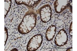 Image no. 1 for anti-Acyl-CoA Thioesterase 7 (ACOT7) (AA 1-339) antibody (ABIN599527) (ACOT7 Antikörper  (AA 1-339))