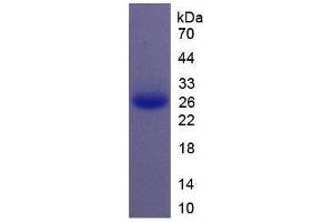 Image no. 2 for Interleukin 11 (IL11) (AA 22-199) (Active) protein (His tag) (ABIN6239760)