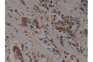 Immunohistochemistry (IHC) image for anti-Proteasome (Prosome, Macropain) 26S Subunit, ATPase, 6 (PSMC6) (AA 2-403) antibody (ABIN1860338)