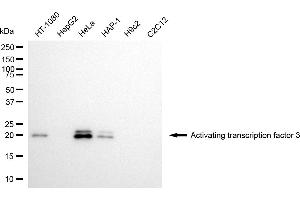 Western blotting analysis using activating transcription factor 3 antibody (ABIN7797482).