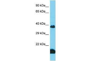 Western Blotting (WB) image for anti-Taste Receptor, Type 2, Member 3 (TAS2R3) (Middle Region) antibody (ABIN2791086)