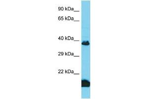 Host: Rabbit Target Name: TAS2R3 Sample Type: Fetal Kidney lysates Antibody Dilution: 1. (TAS2R3 Antikörper  (Middle Region))