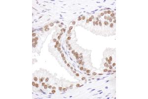anti-serine/arginine-Rich Splicing Factor 6 (SRSF6) (AA 250-300) antibody