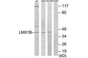 Western blot analysis of extracts from Jurkat/293/HuvEc cells, using LMX1B Antibody.