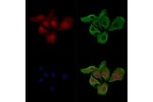 ABIN7093232 and ABIN7097244 staining Hela cells(heat shock treatment) by IF/ICC. (p53 Antikörper  (acLys386))