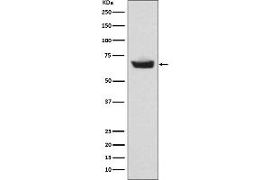 Western blot analysis of CETP expression in human plasma lysate.