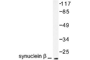Image no. 1 for anti-Synuclein, beta (SNCB) antibody (ABIN271836) (beta Synuclein Antikörper)