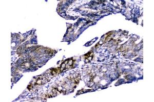 IHC analysis of Cytochrome C using anti-Cytochrome C antibody (ABIN5693008).