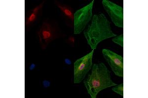 ABIN7094829 and ABIN7098880 staining  cells by IF/ICC.